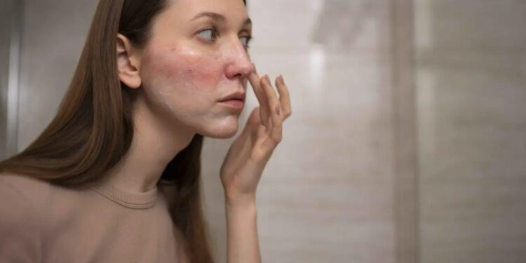 Kulit Kering dan Kasar? Ini 15 Cara Ampuh Mengatasinya!