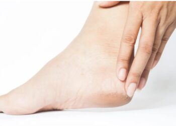 Tumit Pecah-Pecah Bukan Cuma Masalah Estetika—Yuk Kenali Penyebab dan Cara Mengatasinya!